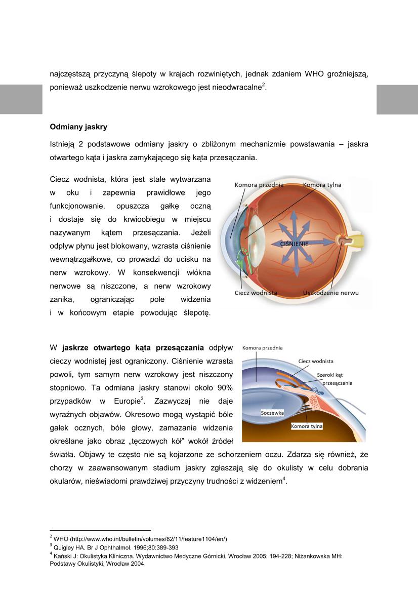Microsoft Word Viewer - Jaskra - podstawowe informacje o problemie_02